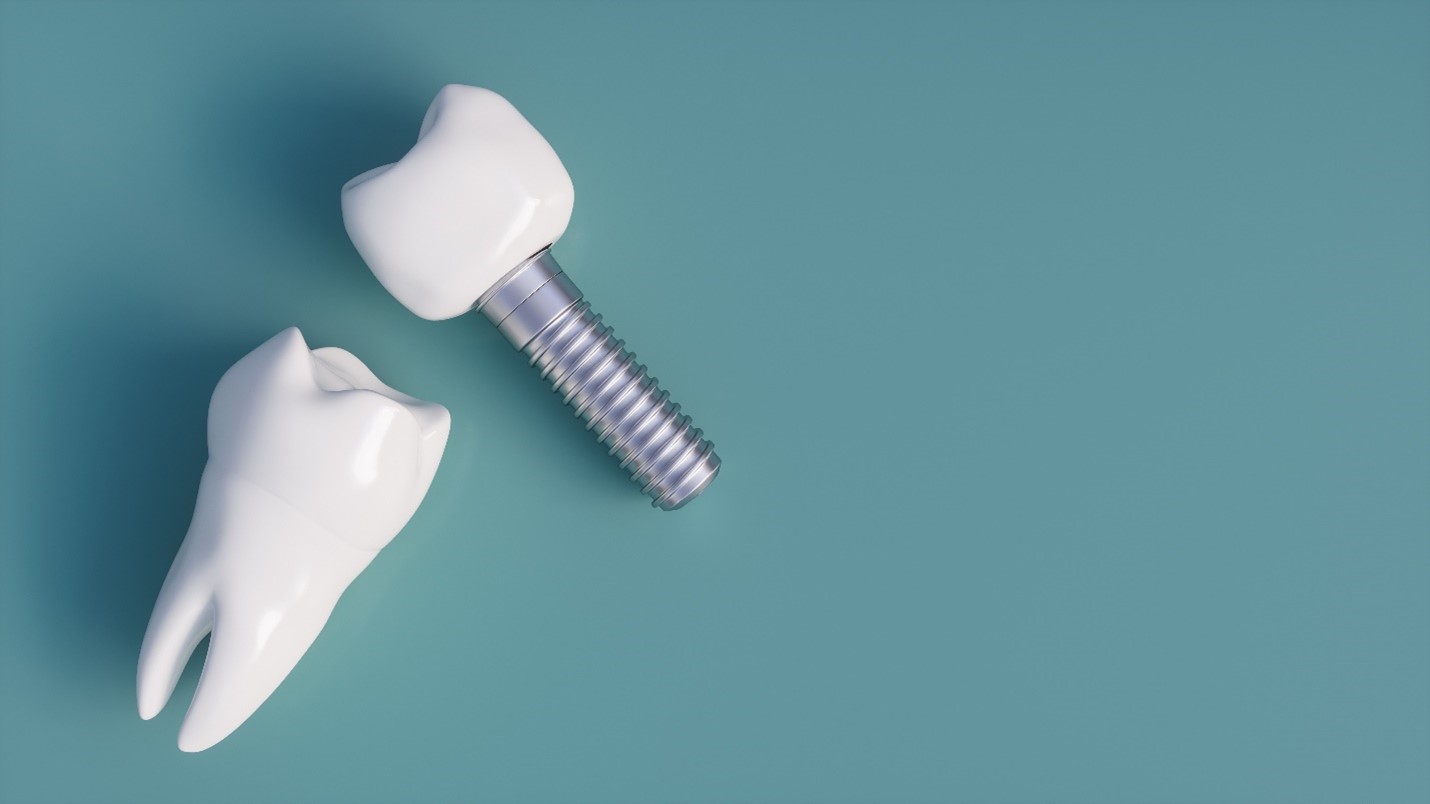 Recognize Dental Implant Failure Longmont | Dr. Brian Coats